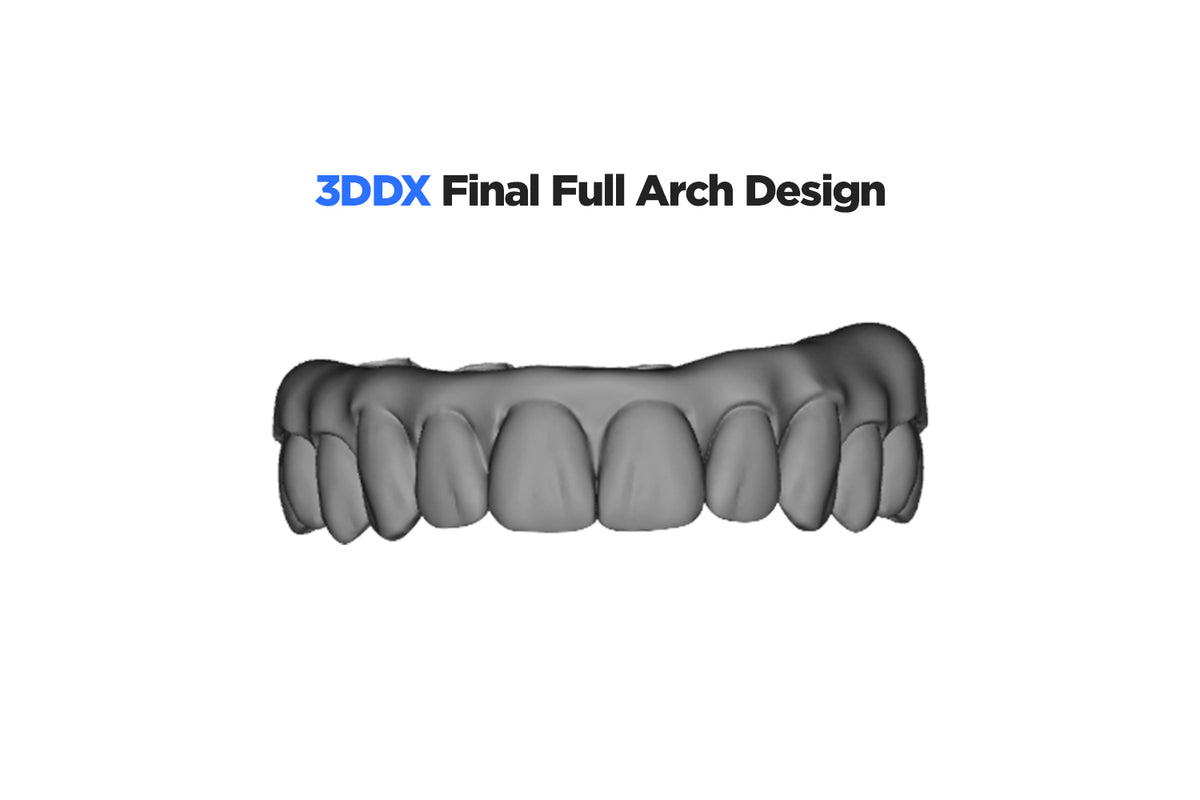 3DDX Final Full Arch Prosthesis Design