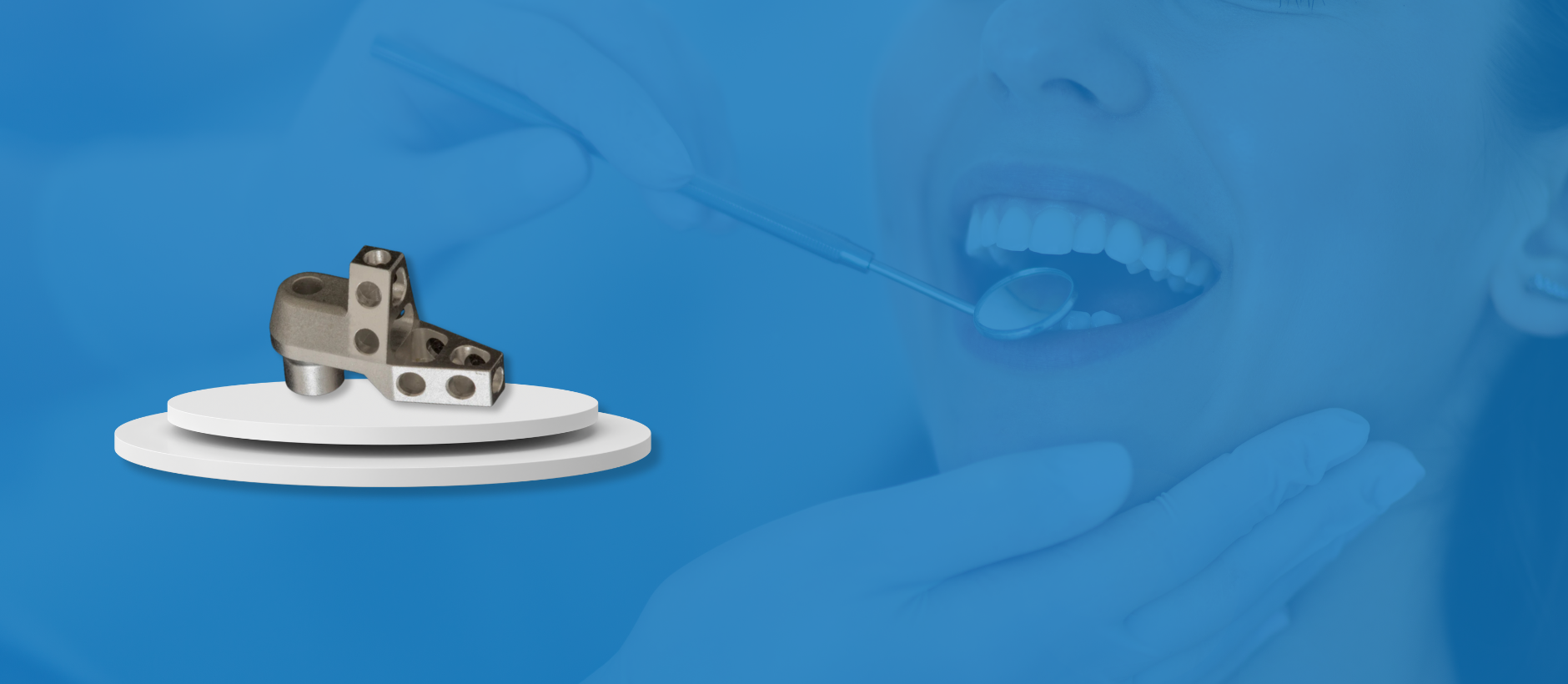 Opti Splint OPTISPLINT by DIGITAL ARCHES – Digital Arches LLC