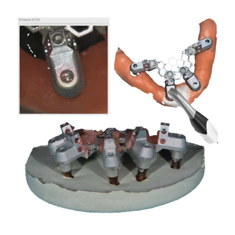 Opti Splint OPTISPLINT by DIGITAL ARCHES – Digital Arches LLC