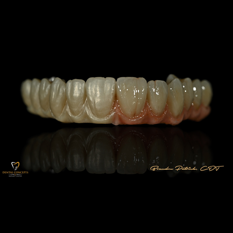 PixelStone™ 8-Layer Full Arch Zirconia