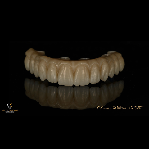PixelStone™ 8-Layer Full Arch Zirconia